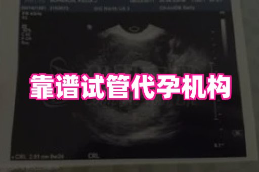 长春助孕网 4